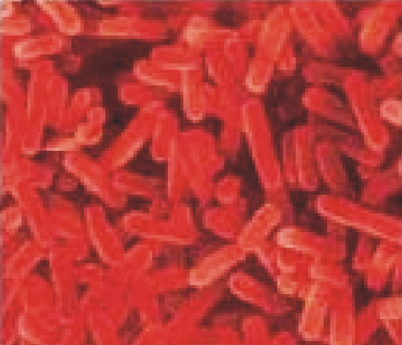 Бактерии легионеллы